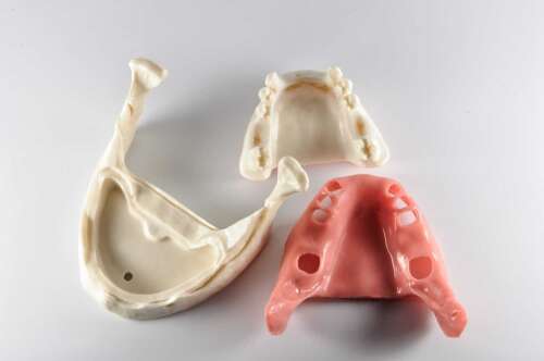 Модель нижней челюсти для имплантации с включенным дефектом зубного ряда и съемной эластичной десной